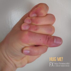 Hug Me